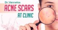 Best Skin Care Clinic near Medipally | Best Skin S